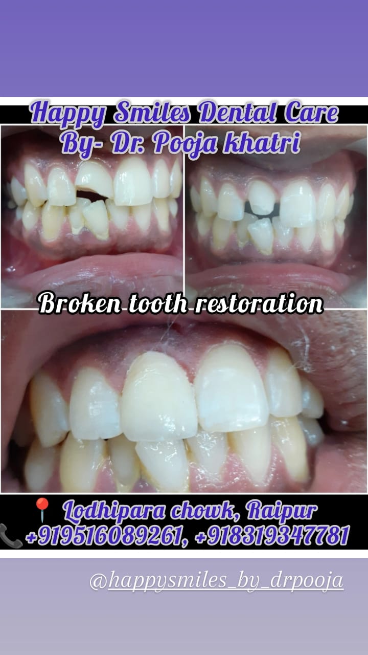 After Treatment